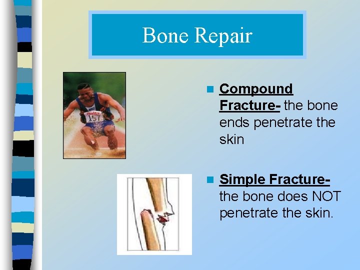 Bone Repair n Compound Fracture- the bone ends penetrate the skin n Simple Fracturethe