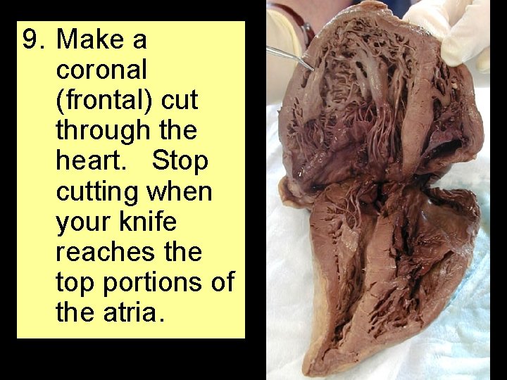 9. Make a coronal (frontal) cut through the heart. Stop cutting when your knife