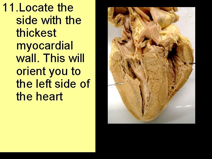 11. Locate the side with the thickest myocardial wall. This will orient you to