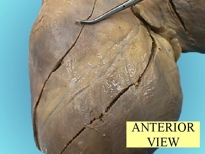 ANTERIOR VIEW 