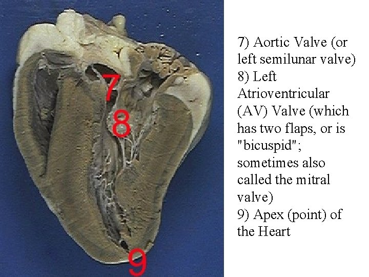 7) Aortic Valve (or left semilunar valve) 8) Left Atrioventricular (AV) Valve (which has