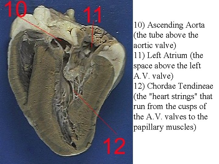 10) Ascending Aorta (the tube above the aortic valve) 11) Left Atrium (the space