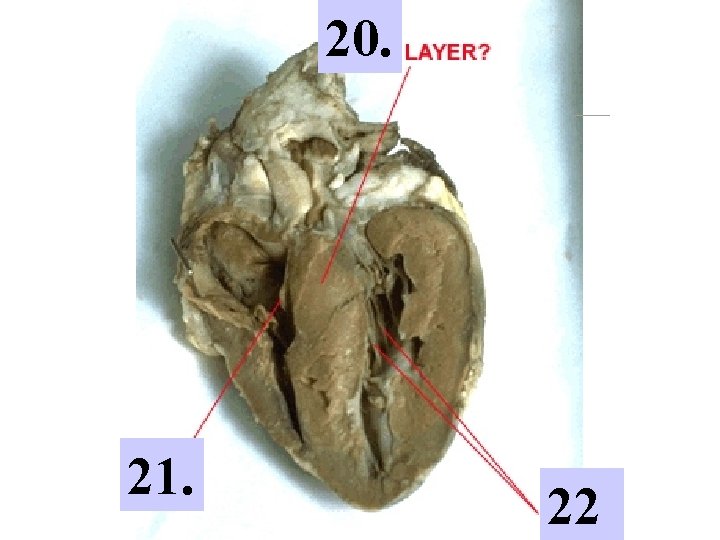 HEART DISSECTION LAB Procedure 1 Obtain a dissection