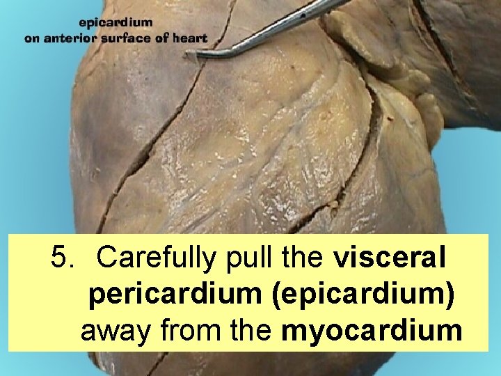 HEART DISSECTION LAB Procedure 1 Obtain a dissection