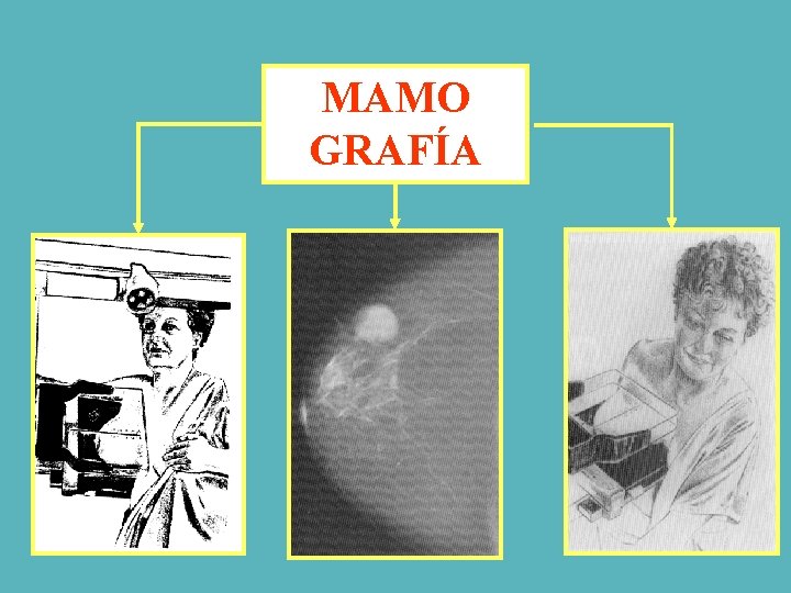 MAMO GRAFÍA 