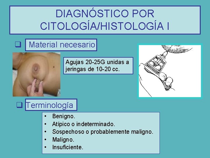 DIAGNÓSTICO POR CITOLOGÍA/HISTOLOGÍA I q Material necesario Agujas 20 -25 G unidas a jeringas
