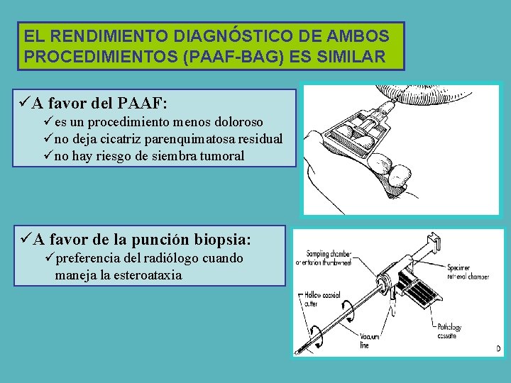 EL RENDIMIENTO DIAGNÓSTICO DE AMBOS PROCEDIMIENTOS (PAAF-BAG) ES SIMILAR üA favor del PAAF: ües