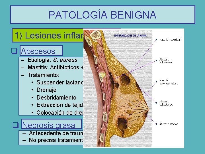 PATOLOGÍA BENIGNA 1) Lesiones inflamatorias q Abscesos – Etiología: S. aureus – Mastitis: Antibióticos
