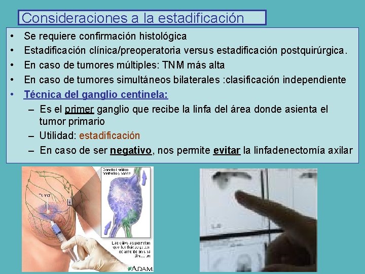 Consideraciones a la estadificación • • • Se requiere confirmación histológica Estadificación clínica/preoperatoria versus