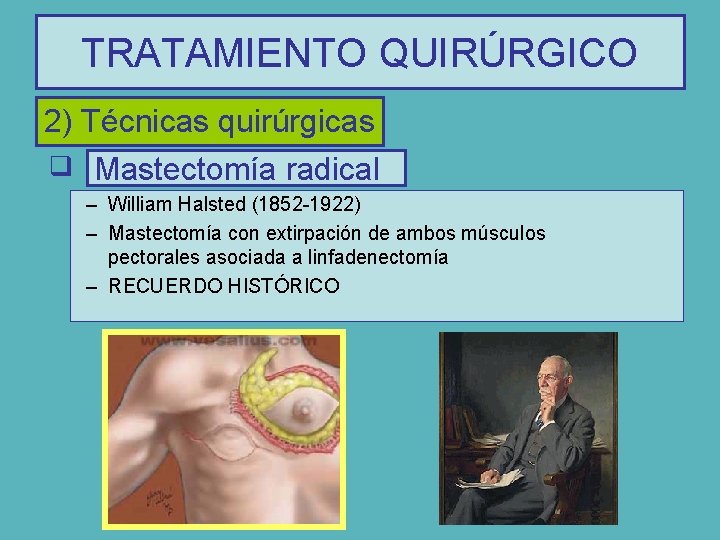 TRATAMIENTO QUIRÚRGICO 2) Técnicas quirúrgicas q Mastectomía radical – William Halsted (1852 -1922) –