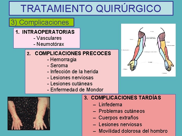 TRATAMIENTO QUIRÚRGICO 3) Complicaciones 1. INTRAOPERATORIAS - Vasculares - Neumotórax 2. COMPLICACIONES PRECOCES -