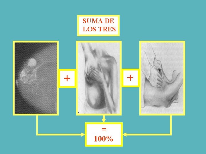 SUMA DE LOS TRES + + = 100% 