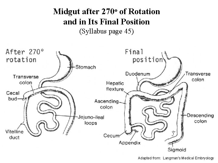 Midgut after 270 o of Rotation and in Its Final Position (Syllabus page 45)