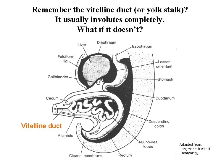 Remember the vitelline duct (or yolk stalk)? It usually involutes completely. What if it