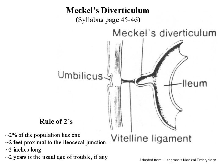 Meckel’s Diverticulum (Syllabus page 45 -46) Rule of 2’s ~2% of the population has