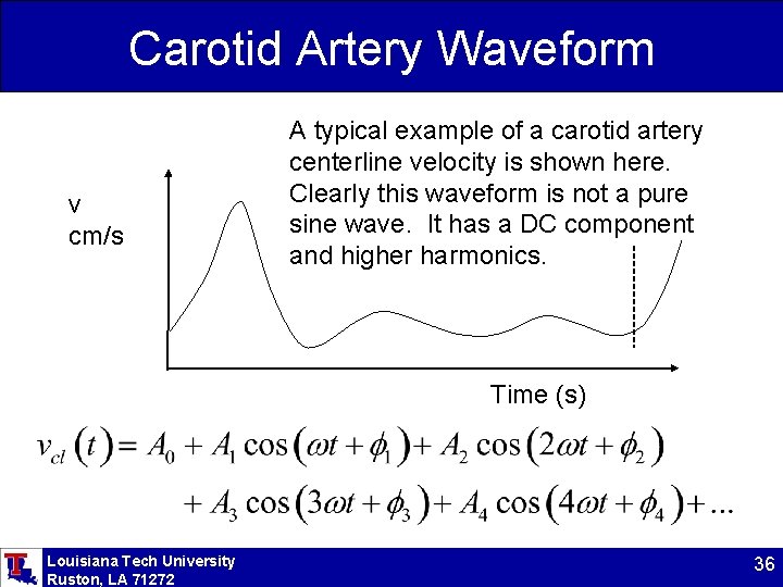 Carotid Artery Waveform v cm/s A typical example of a carotid artery centerline velocity