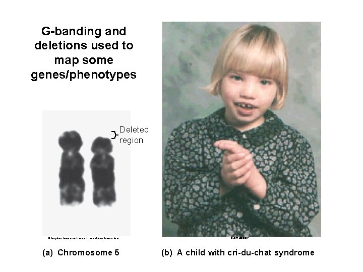 G-banding and deletions used to map some genes/phenotypes Deleted region © Biophoto Assocates/Science Source/Photo