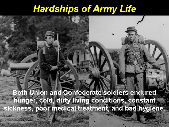 Hardships of Army Life Both Union and Confederate soldiers endured hunger, cold, dirty living Hardships of Army Life Both Union and Confederate soldiers endured hunger, cold, dirty living