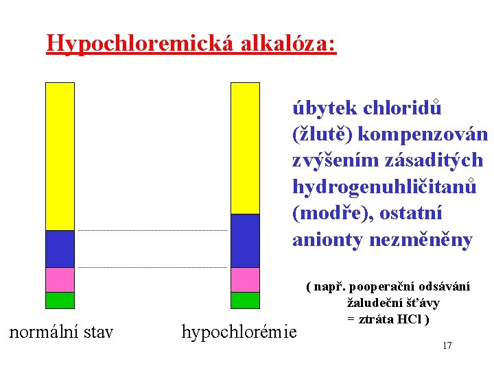 Hypochloremická alkalóza: úbytek chloridů (žlutě) kompenzován zvýšením zásaditých hydrogenuhličitanů (modře), ostatní anionty nezměněny normální