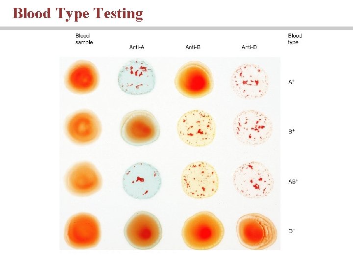 Blood Type Testing 