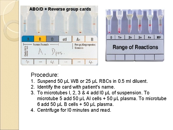 ABO/D + Reverse group cards Procedure: 1. Suspend 50 µL WB or 25 µL