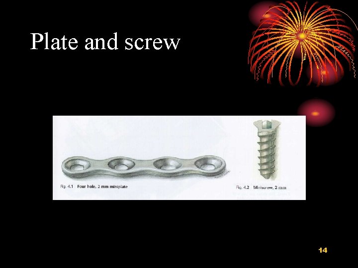 Plate and screw 14 