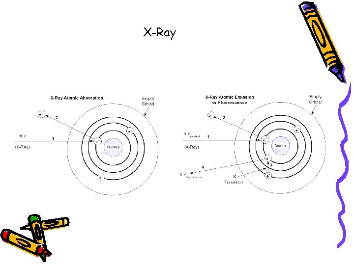 X-Ray 