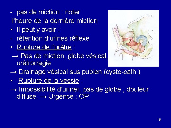 - pas de miction : noter l’heure de la dernière miction • Il peut