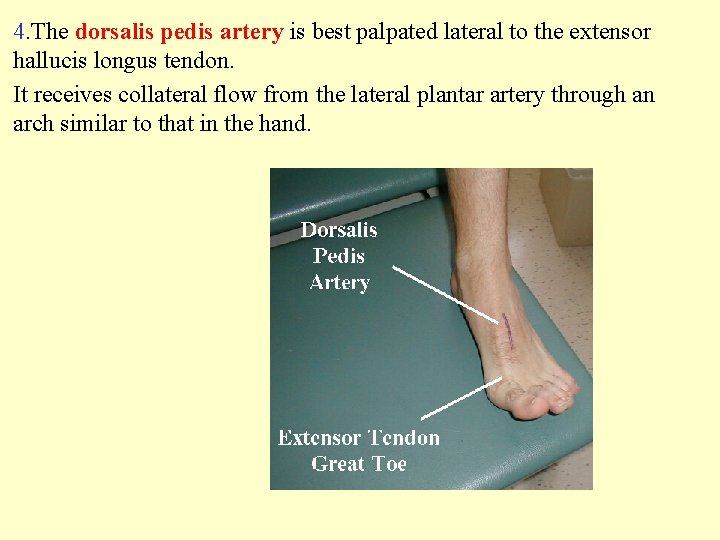 4. The dorsalis pedis artery is best palpated lateral to the extensor hallucis longus