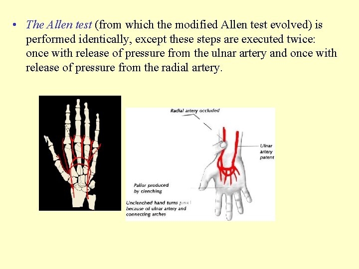  • The Allen test (from which the modified Allen test evolved) is performed