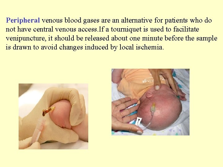 Peripheral venous blood gases are an alternative for patients who do not have central