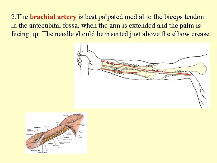 2. The brachial artery is best palpated medial to the biceps tendon in the