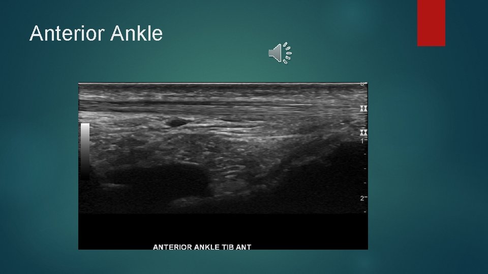 Anterior Ankle 