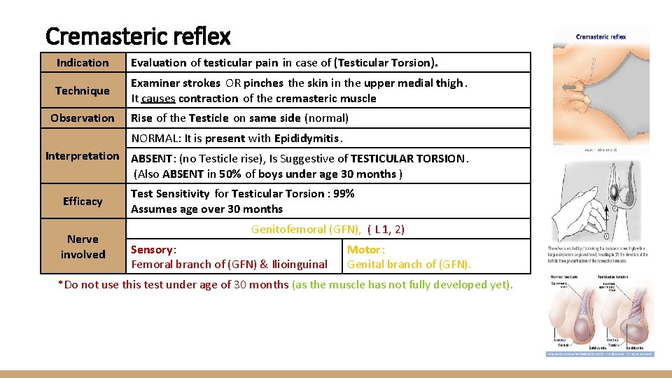 Cremasteric reflex Indication Evaluation of testicular pain in case of (Testicular Torsion). Technique Examiner