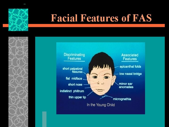 Facial Features of FAS 