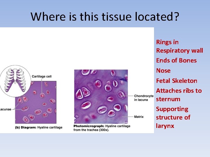 Where is this tissue located? Rings in Respiratory wall Ends of Bones Nose Fetal