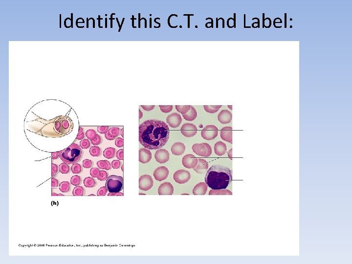 Identify this C. T. and Label: Identify this C. T. and Label: