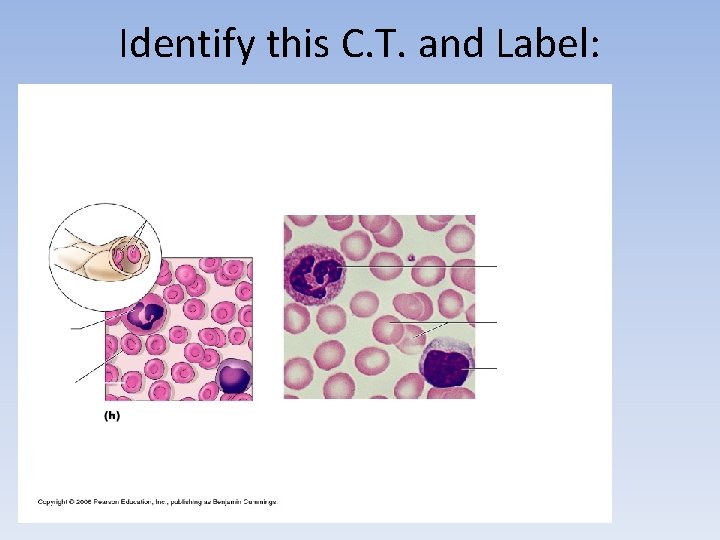 Identify this C. T. and Label: 