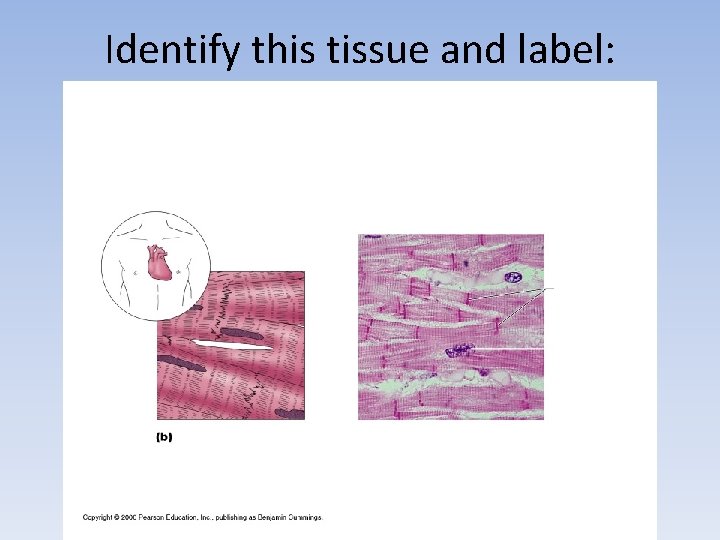 Identify this tissue and label: 