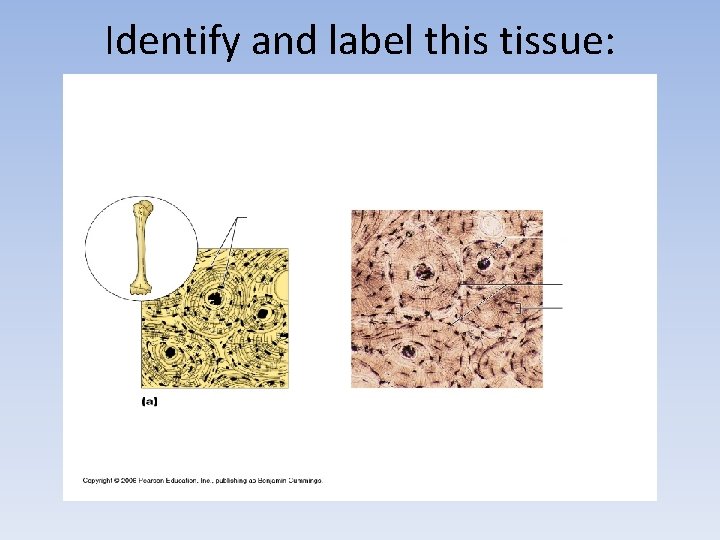 Identify and label this tissue: 