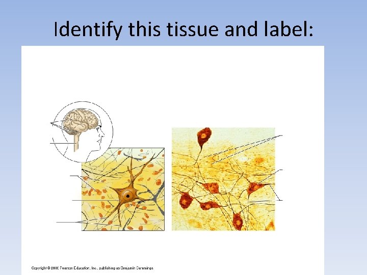 Identify this tissue and label: 