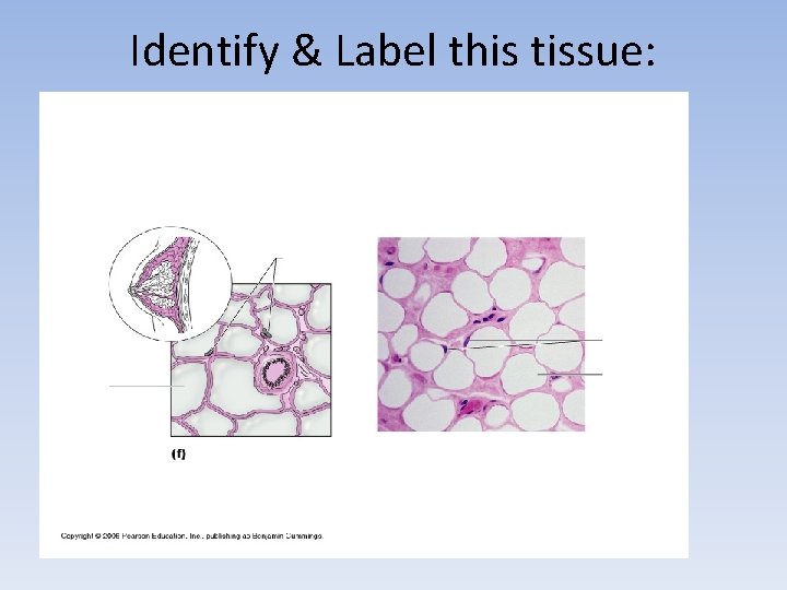 Identify & Label this tissue: 