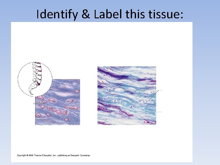 Identify & Label this tissue: Identify & Label this tissue: