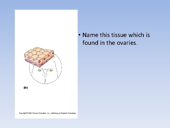 • Name this tissue which is found in the ovaries. • Name this tissue which is found in the ovaries.