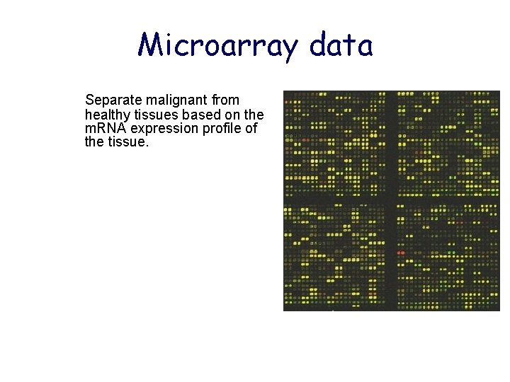 Microarray data Separate malignant from healthy tissues based on the m. RNA expression profile