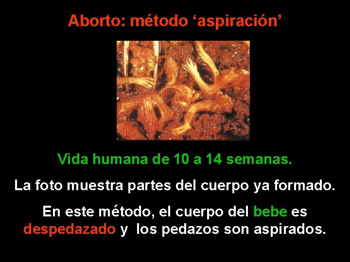 Aborto: método ‘aspiración’ Vida humana de 10 a 14 semanas. La foto muestra partes