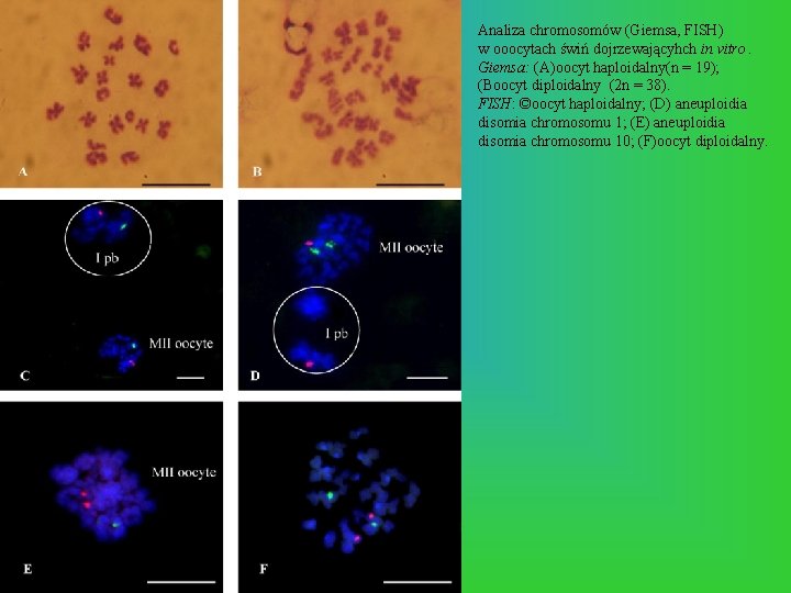 Analiza chromosomów (Giemsa, FISH) w ooocytach świń dojrzewającyhch in vitro. Giemsa: (A)oocyt haploidalny(n =