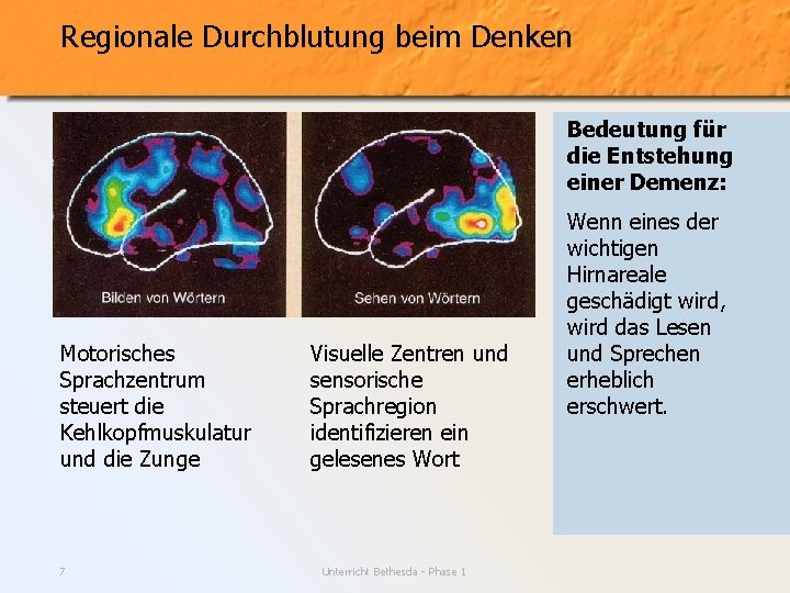 Regionale Durchblutung beim Denken Bedeutung für die Entstehung einer Demenz: Motorisches Sprachzentrum steuert die