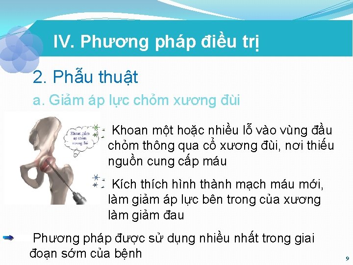 IV. Phương pháp điều trị 2. Phẫu thuật a. Giảm áp lực chỏm xương