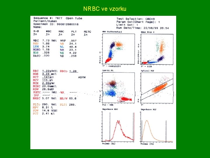 NRBC ve vzorku 